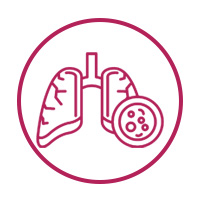 Lung Cancer